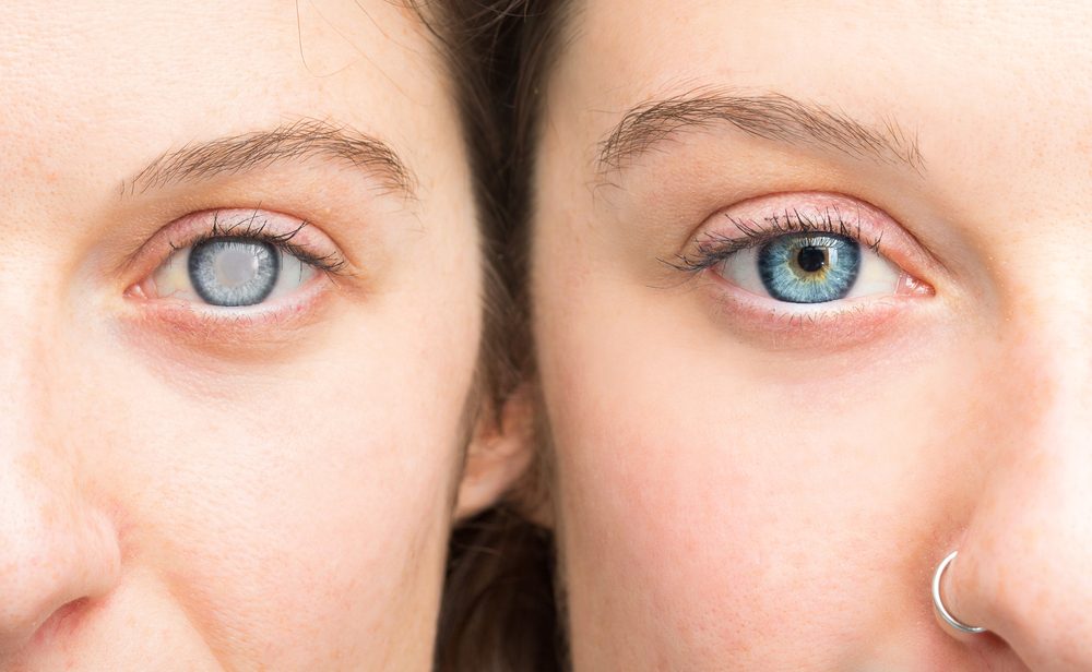 How Can Supplements Help With Specific Eye Conditions?